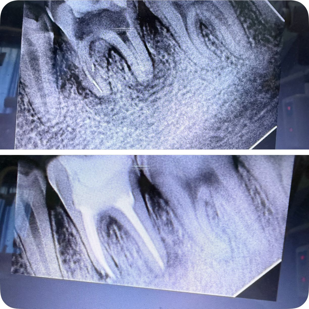 Re RCT of failure case